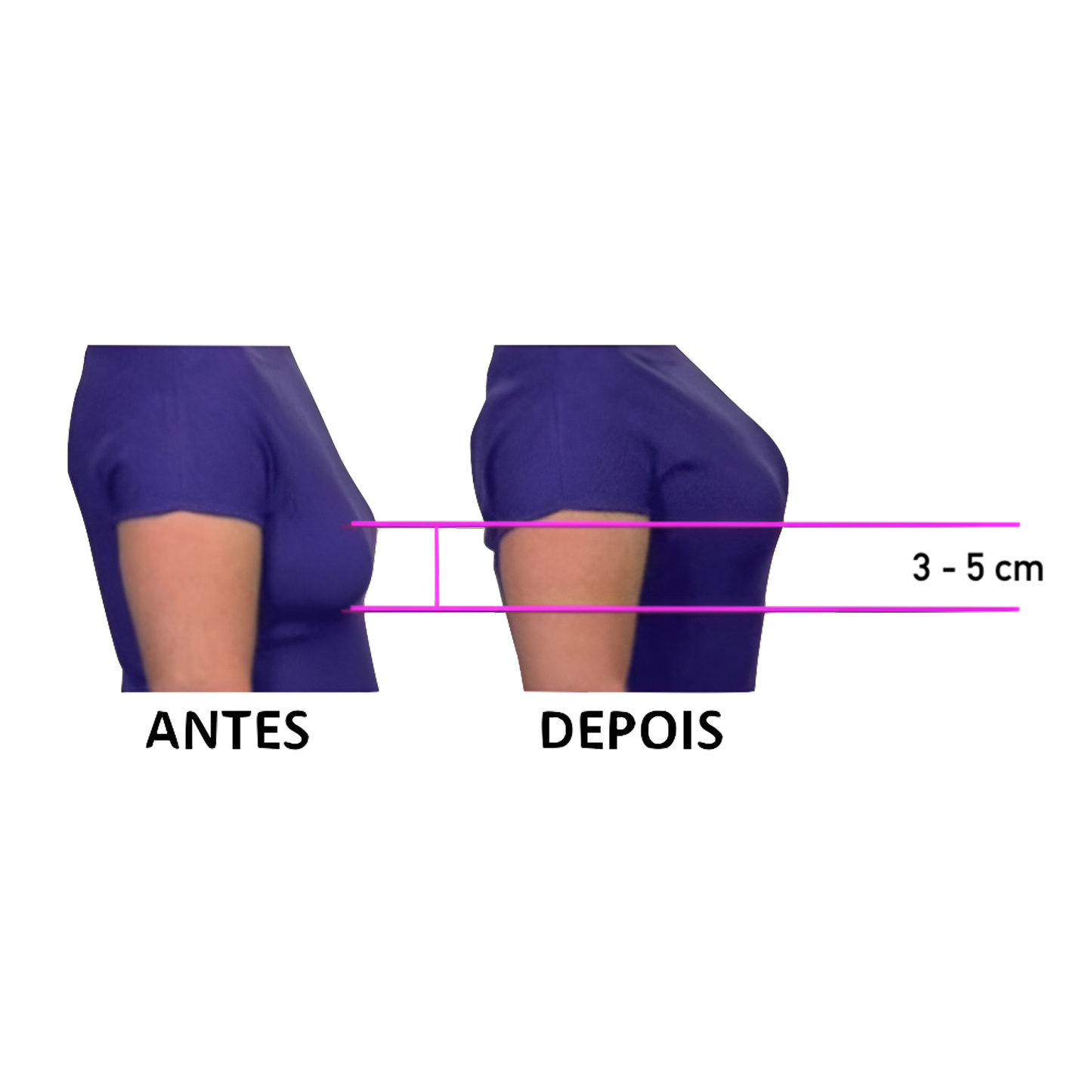 Sensilift®